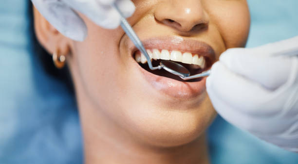 Best Chipped Tooth Repair Near Me  in Wilber, NE